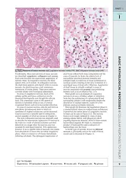 Wheater's Basic Pathology: A Text, Atlas, and Review of Histopathology. International Edition, 5th Edition - Вільям Стюарт - миниатюра 12