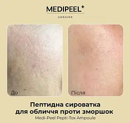Сироватка для обличчя Medi-Peel Pepti Tox Ampoule пептидна антивікова розгладжуюча 30 мл - мініатюра 4
