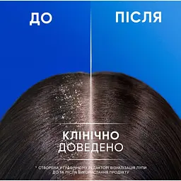 Шампунь Head & Shoulders 2 в 1 Проти лупи Яблучна свіжість 330 мл (8700216304689) - мініатюра 6