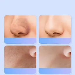 Ультразвуковий скрабер для очищення обличчя Skin Tech Scrubber 3305 Білий (3305O) - мініатюра 4