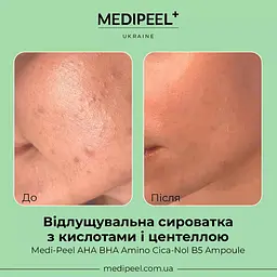 Сироватка для обличчя Medi-Peel AHA BHA Amino Cica-Nol B5 Ampoule відлущувальна 30 мл - мініатюра 4