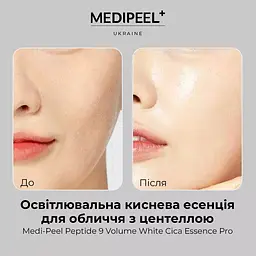 Есенція для обличчя Medi-Peel Peptide 9 Volume White Cica Essence Pro освітлювальна киснева з центеллою 100 мл - мініатюра 5