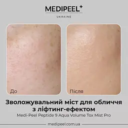 Міст для обличчя  Medi-Peel Peptide 9 Aqua Volume Tox Mist Pro зволожувальний з ліфтинг-ефектом 50 мл - мініатюра 4