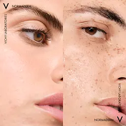 Міцелярна вода Vichy 3в1 Normaderm, для зняття макіяжу та очищення жирної чутливої шкіри обличчя та очей 200 мл (M3262021) - мініатюра 10