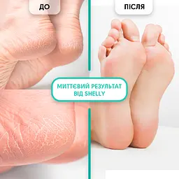 Гель-кератолітик Shelly Professional Care М'яке лезо 200 мл - мініатюра 4
