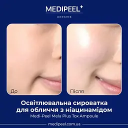 Сироватка для обличчя Medi-Peel Mela Plus Tox Ampoule освітлювальна з ніацинамідом 35 мл - мініатюра 4