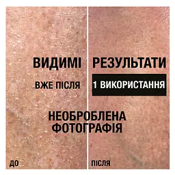 Лосьйон для тіла Neutrogena Інтенсивне відновлення 250 мл - мініатюра 6
