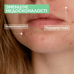 Очищувальний гель Mixa проти недоліків шкіри обличчя 150 мл - мініатюра 4