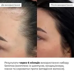 Шампунь Hillary Serenoa & РР Hair Loss Control проти випадіння волосся 250 мл - мініатюра 12