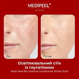 Освітлювальний стік із глутатіоном Medi Peel Bio-Intense Glutathione White Stick 10 г - мініатюра 4