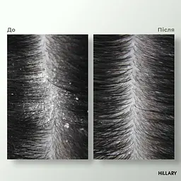 Энзимный пилинг для кожи головы + Набор для жирного типа волос Green Tea Phyto-essential Hillary - миниатюра 13