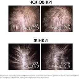 Сироватка Vichy Dercos Aminexil Clinical Regen Booster для відновлення густоти та боротьби з випадінням волосся 90 мл - мініатюра 4