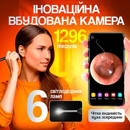 Пристрій для видалення вушної сірки з камерою Brillix 1296P Чорний (PO-Black) - мініатюра 3