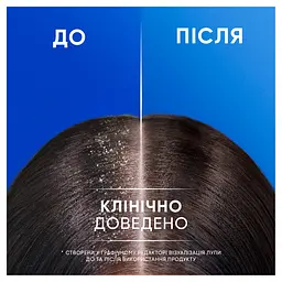 Шампунь Head & Shoulders Apple Fresh 2 в 1 проти лупи з кондиціонером 330 мл - мініатюра 6
