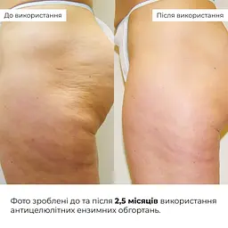 Уцінка. Набір антицелюлітних розігрівальних обгортань Hillary Heating Anti-Cellulite Wrap Set  - мініатюра 9