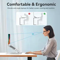Підставка для ноутбука Laptop X-type Stand Silver Aluminum Alloy Vention - мініатюра 6