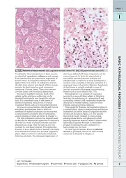 Wheater's Basic Pathology: A Text, Atlas, and Review of Histopathology. International Edition, 5th Edition - мініатюра 12