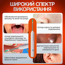 Пристрій для видалення вушної сірки з камерою Brillix 1296P Білий (PO-White) - мініатюра 4