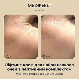 Ліфтинг-крем для шкіри навколо очей Medi-Peel Peptide-Tox Bor Eye Cream з пептидним комплексом 40 мл - мініатюра 5