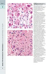 Wheater's Basic Pathology: A Text, Atlas, and Review of Histopathology. International Edition, 5th Edition - Вільям Стюарт - миниатюра 11