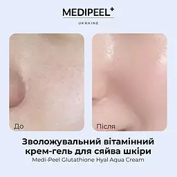 Крем-гель для обличчя Medi-Peel Glutathione Hyal Aqua Cream зволожувальний вітамінний 50 мл - мініатюра 5