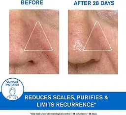 Заспокійлива емульсія Uriage DS Regulating Soothing Emulsion проти себорейного дерматиту 40 мл - мініатюра 7