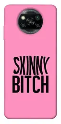 Чохол Demsky Skinny для Xiaomi Poco X3 NFC / Poco X3 Pro