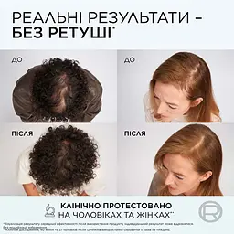 Кондиціонер L'Oreal Paris Elseve Growth Booster для боротьби з випадінням та ламкістю волосся 150 мл - мініатюра 6