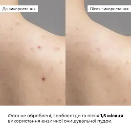 Ензимна очищувальна пудра Hillary Enzyme Probio Cleanser Powder для нормальної сухої та чутливої шкіри 40 г - мініатюра 10