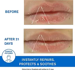 Заспокійлива емульсія Uriage DS Regulating Soothing Emulsion проти себорейного дерматиту 40 мл - мініатюра 6