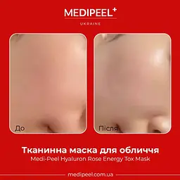 Тканинна маска для обличчя Medi-Peel Hyaluron Rose Energy Tox Mask 30 мл - мініатюра 2