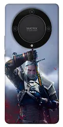 TPU чохол Demsky The witcher gerald для Huawei Magic5 Lite