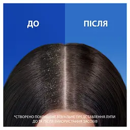 Шампунь Head & Shoulders 2 в 1 Проти лупи Свіжість ментолу 330 мл (8700216304825) - мініатюра 6