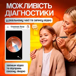 Пристрій для видалення вушної сірки з камерою Brillix 1296P Чорний (PO-Black) - мініатюра 2