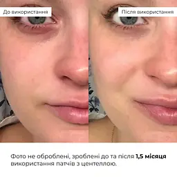 Набір для експрес-відновлення та зняття набряків Hillary - мініатюра 10