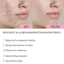 Крем для всіх типів шкіри з ніацинамідом та вітаміном Е Reclaire cosmetics 30 мл - мініатюра 4