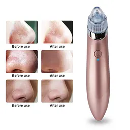 Вакуумний очищувач шкіри Menqahahayd XN-8030 Pink (np2_00120) - мініатюра 5