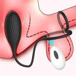 Вібратор Kinky 3 в 1: ерекційне кільце з масажером простати, вібратор для пар, віброяйце - мініатюра 9