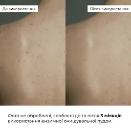 Ензимна очищувальна пудра Hillary Enzyme Balance Cleanser Powder для жирної та комбінованої шкіри 40 г - мініатюра 10