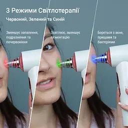 Очищувач шкіри та пор AIMED Pore Cleaner Hot&Cold вакуумний колір білий - мініатюра 4