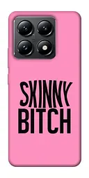 Чохол Demsky Skinny для Xiaomi 14T