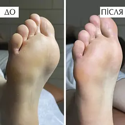 Пінка для розм’якшення ороговілої шкіри на стопах PNB PedicureFoam 150 мл - мініатюра 3