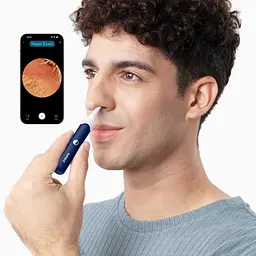 Прилад для видалення вушної сірки (отоскоп) Xiaomi Bebird EarSight Plus (D39R) Blue - мініатюра 7