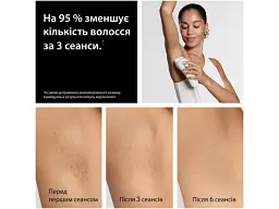 Фотоепілятор Braun Silk Expert Pro 5 PL5351 (8700216938051) - мініатюра 3