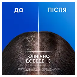 Шампунь проти лупи Head & Shoulders Основний догляд 2-в-1 400 мл - мініатюра 5