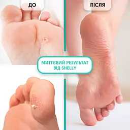 Гель-кератолітик Shelly Professional Care М'яке 100 мл - мініатюра 4