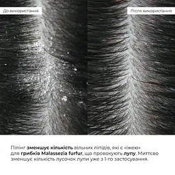 Комплекс для догляду за жирним типом волосся Hillary Perfect Care Hair Green Tea - мініатюра 24