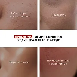 Набір Hillary для боротьби з лущенням та інтенсивної регенерації - мініатюра 6
