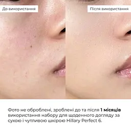 Набір Hillary для щоденного догляду за сухою і чутливою шкірою 6 - мініатюра 2