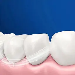 Електрична зубна щітка Oral-B Junior Frozen D505.513.Z3K 3772 [97203] - мініатюра 4